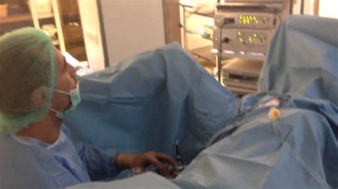 видео как да се направи операция при аденом на простатата